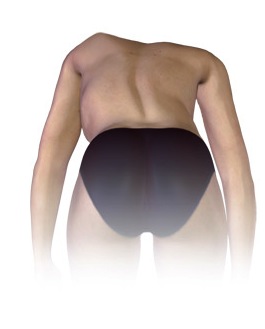 Spine surgeon South Carolina, Minimally invasive spine surgery, Artificial disc replacement Spine surgeon, second opinion, Herniated disc, Laser spine surgery, neurosurgery south Carolina, Second opinion for spine surgery, Home remedies for pain, Spine center of excellence South Carolina, orthopedic surgeon south carolina