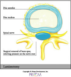 Spine surgeon South Carolina, Minimally invasive spine surgery, Artificial disc replacement Spine surgeon, second opinion, Herniated disc, Laser spine surgery, neurosurgery south Carolina, Second opinion for spine surgery, Home remedies for pain, Spine center of excellence South Carolina, orthopedic surgeon south carolina